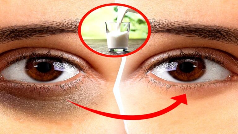milk for dark circles