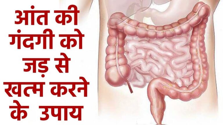 एकदम साफ हो जाएगी आंतों की गंदगी, ये 7 चीजें कर देंगी चकाचक! aanton ki gandgi
