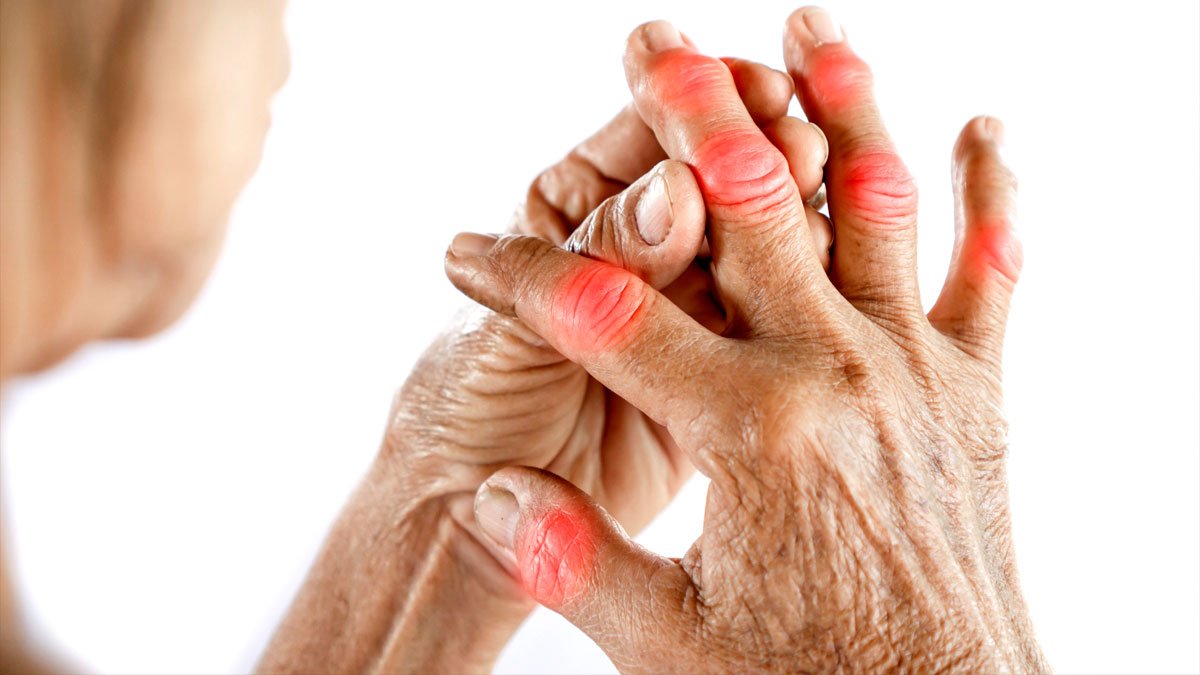 control arthritis pain