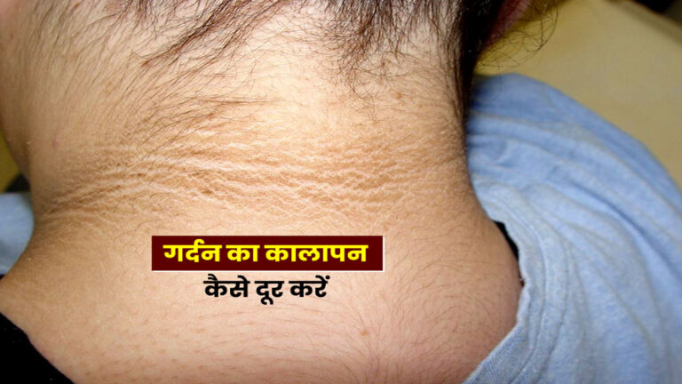 kali gardan kaise saaf kare