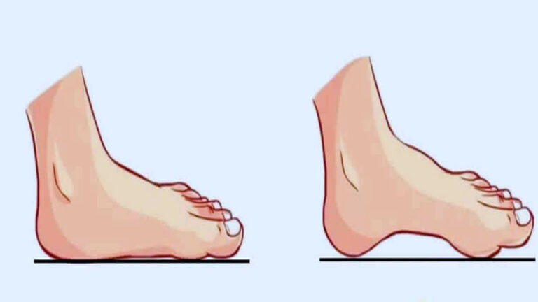 Personality Test: पैरों के तलवे खोलते हैं पर्सनालिटी का यह राज, खुद जानें कैसे इंसान हैं आप pairon ke talwe ki banawat