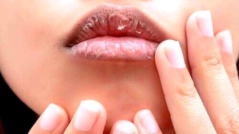 faten hoth kaise thik karen