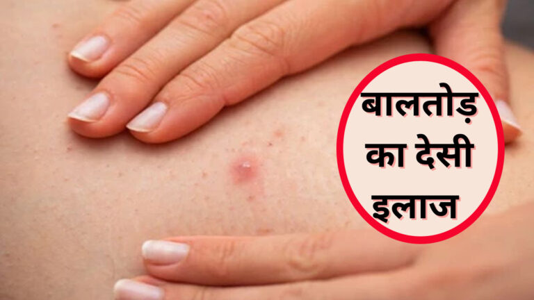 baltod me kya na khaen